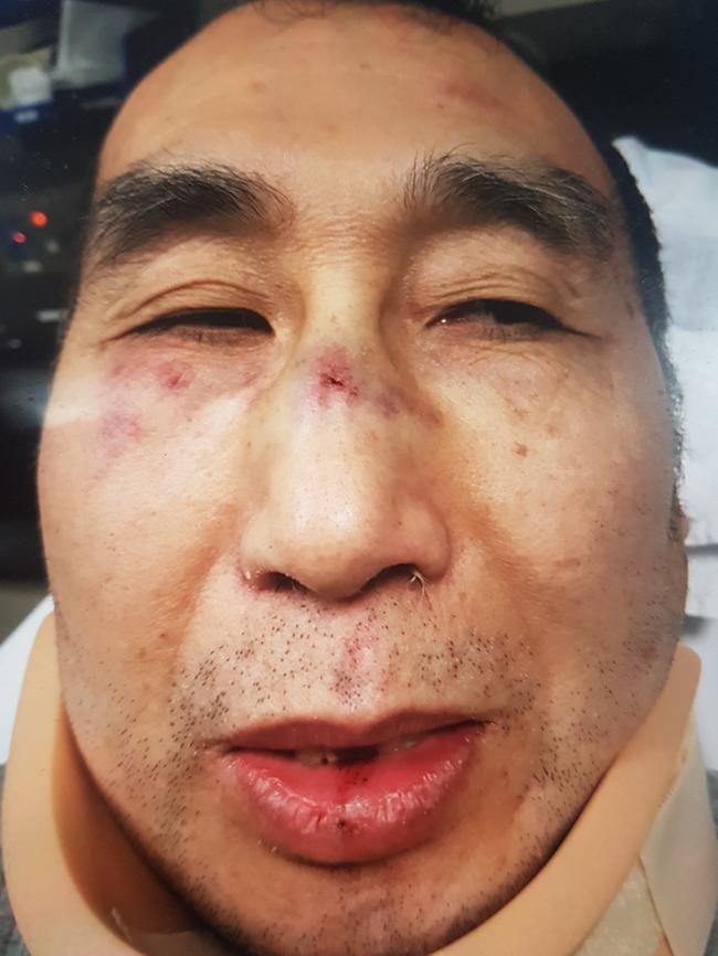 Preston milk bar owner Xing Ming Lin was injured when his shop was robbed.