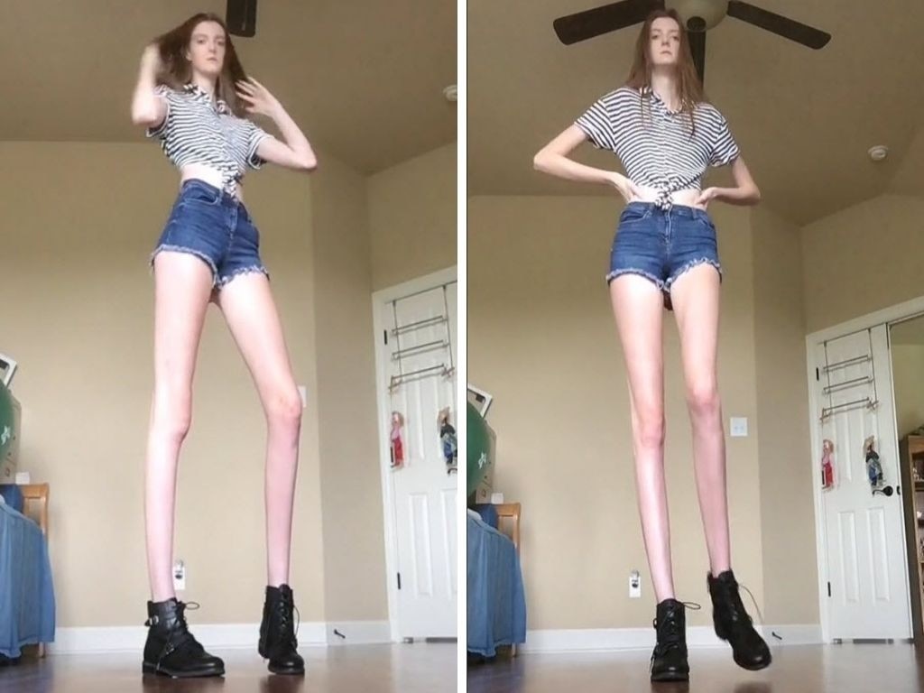 Mummy Long Legs: Ex Australian Model Bids For World's Longest Legs 