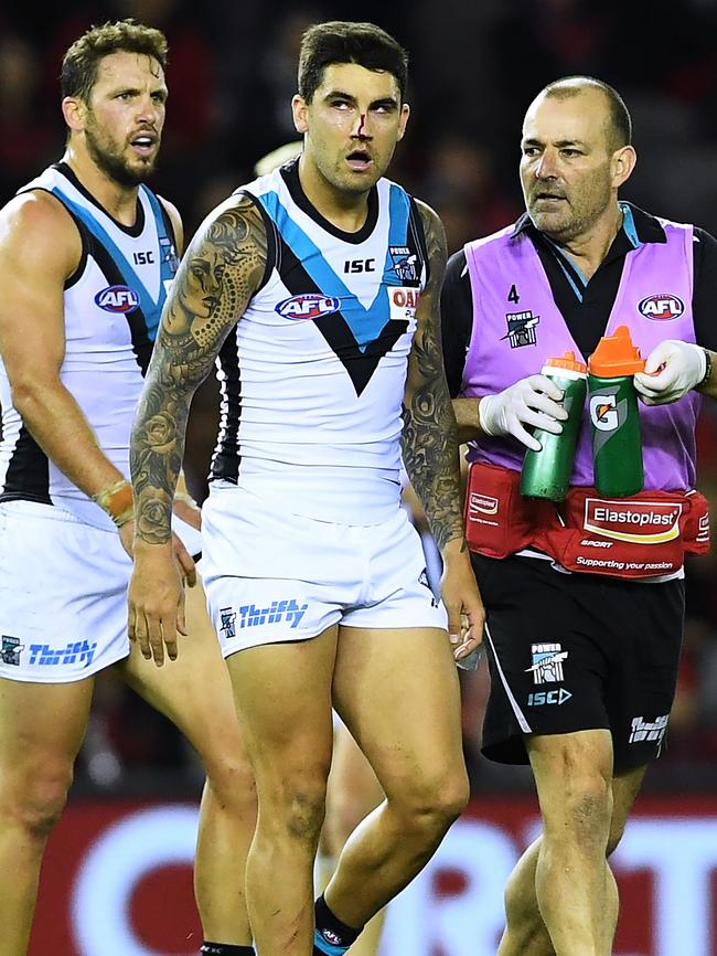 Chad Wingard leaves the ground with a bloodied nose.