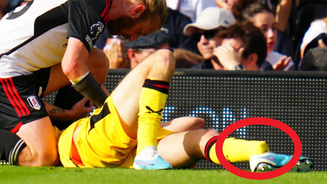 Premier League player suffers sickening broken leg injury