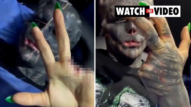 World’s 'most modified' man chops off two fingers