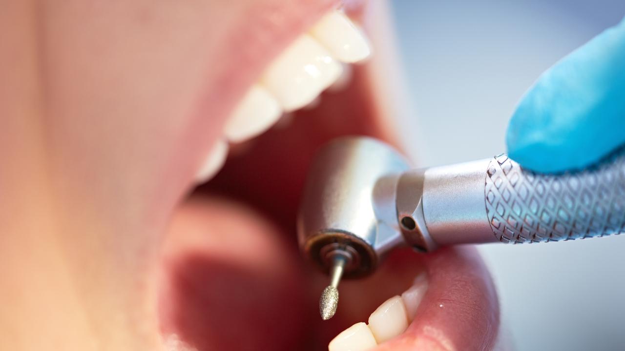 Australians use Extras insurance to reduce dental costs more than anything else. Photo: iStock