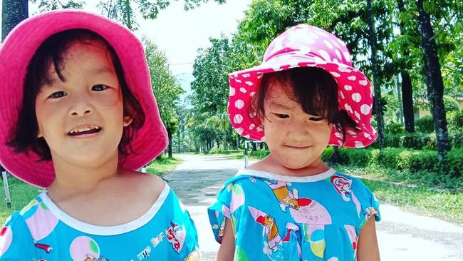 Formerly conjoined twins Nima and Dawa have just turned three