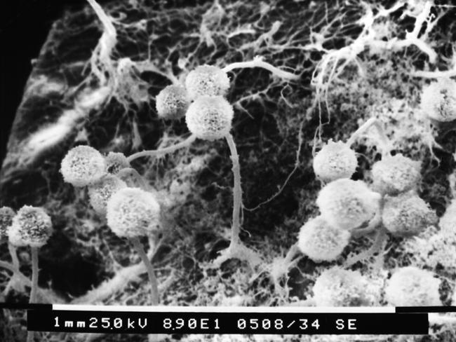 Aspergillus could spread. Picture: CDC/Janice Haney Carr