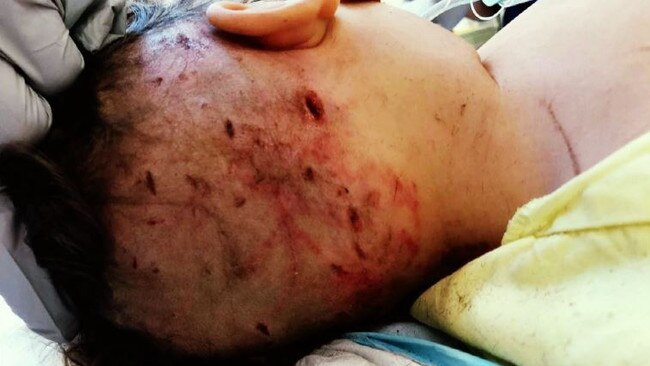 Hunter Allister was attacked by a dingo on Fraser Island when camping with his parents Luke &amp; Sarah Allister – Photo Supplied Ch 9