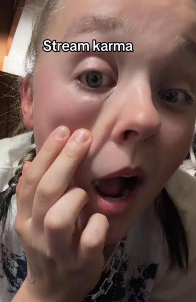 JoJo Siwa has sparked concern among fans after revealing she had gotten a swollen eye. Picture: TikTok.