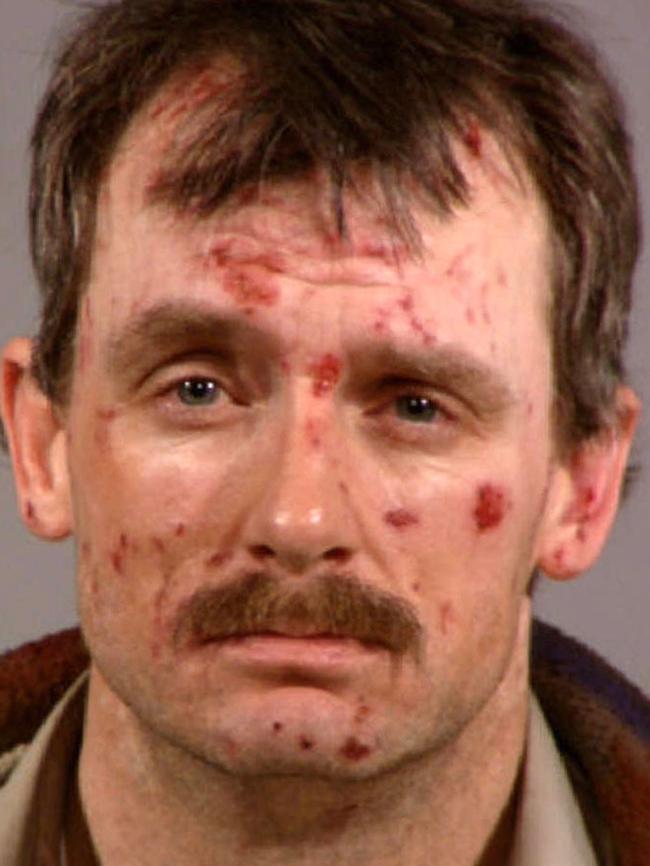 What meth usage does to the face.