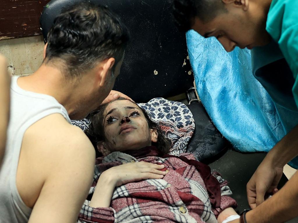 An injured Palestinian girl is comforted as she lies on a gurney at the Al-Aqsa Hospital following the Israeli bombardment of in Deir el-Balah, in the central Gaza Strip. Picture: AFP