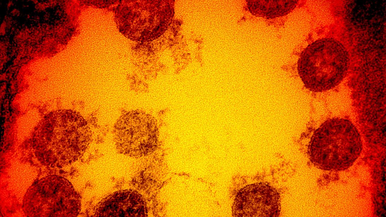 Australia has announced a new program to battle animal diseases. This image shows a transmission electron micrograph of SARS-CoV-2 virus particles.