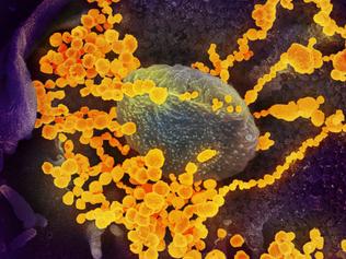 Missed virus infections exploding globally