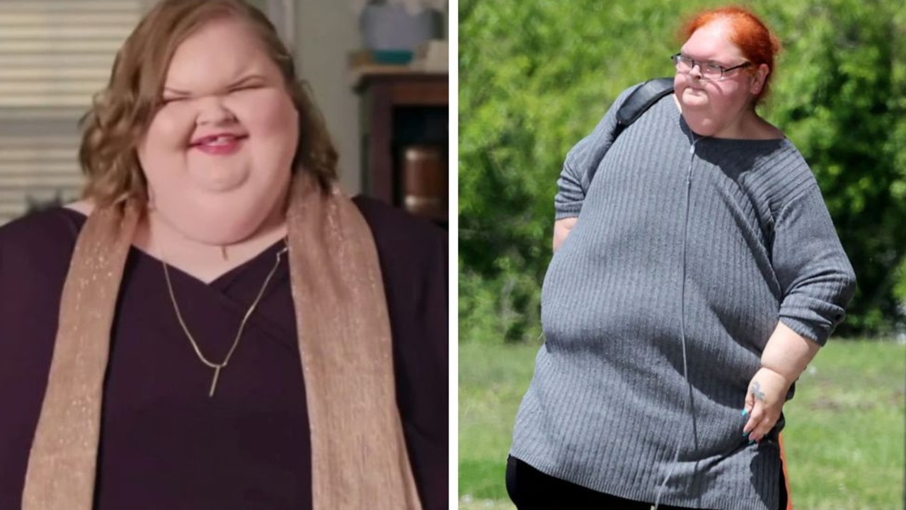 1000 Lb Sisters Star Tammy Slatons Dramatic Weight Loss After Surgery