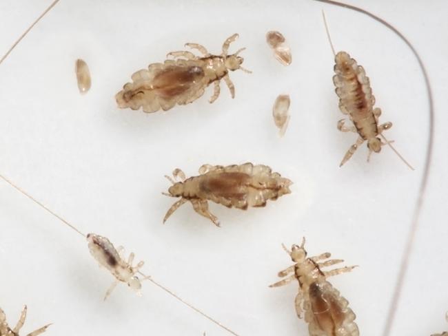 Head Louse Infestation Head lice at various stages of development from egg to imago ( adult ) on white background . Istock image