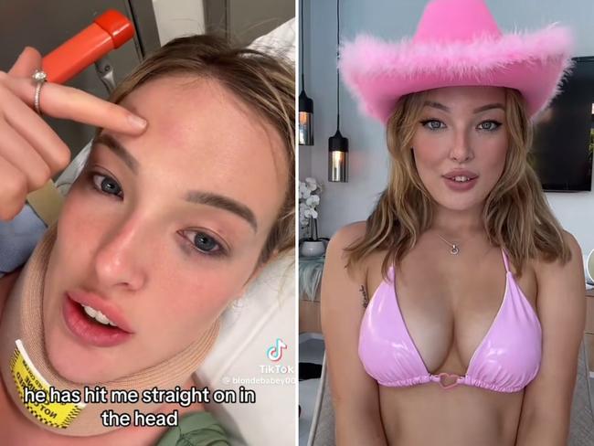 Influencer Millie Hannah ‘king hit’ in Surfers Paradise