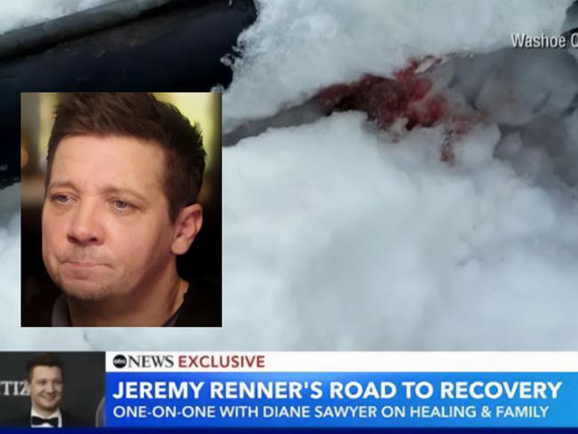 Jeremy Renner slow plough acciddent first photos.