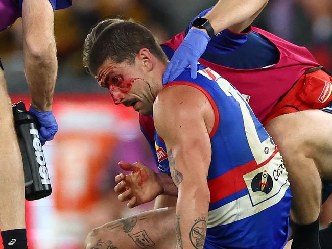 MELBOURNE, AUSTRALIA - MAY 05: Tom Liberatore of the Bulldogs is attended to by trainers during the round eight AFL match between Western Bulldogs and Hawthorn Hawks at Marvel Stadium, on May 05, 2024, in Melbourne, Australia. (Photo by Quinn Rooney/Getty Images)