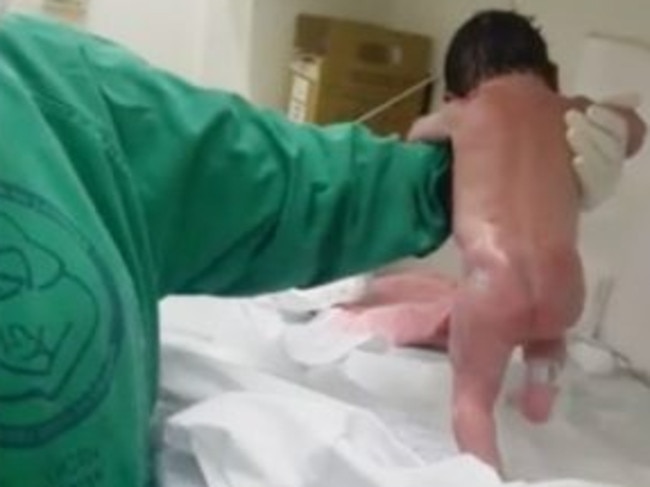 Baby walking after birth viral video online