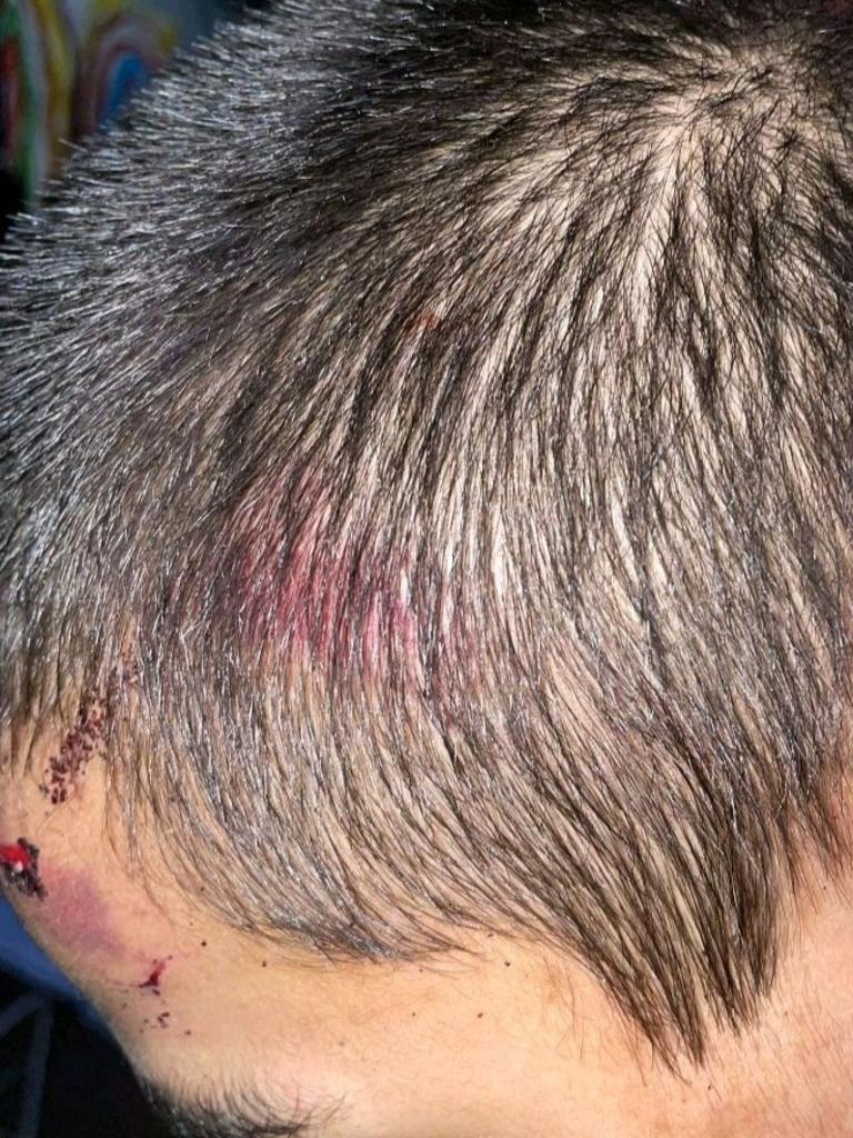 A 15-year-old boy sustain injuries to his head. Picture: supplied