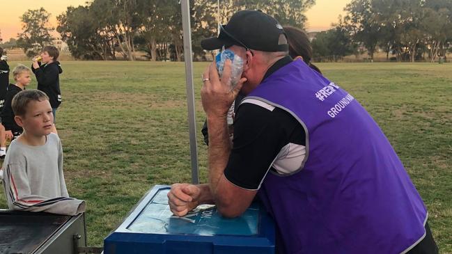 Ground manager Steve Avey with an ice pack after being punched.