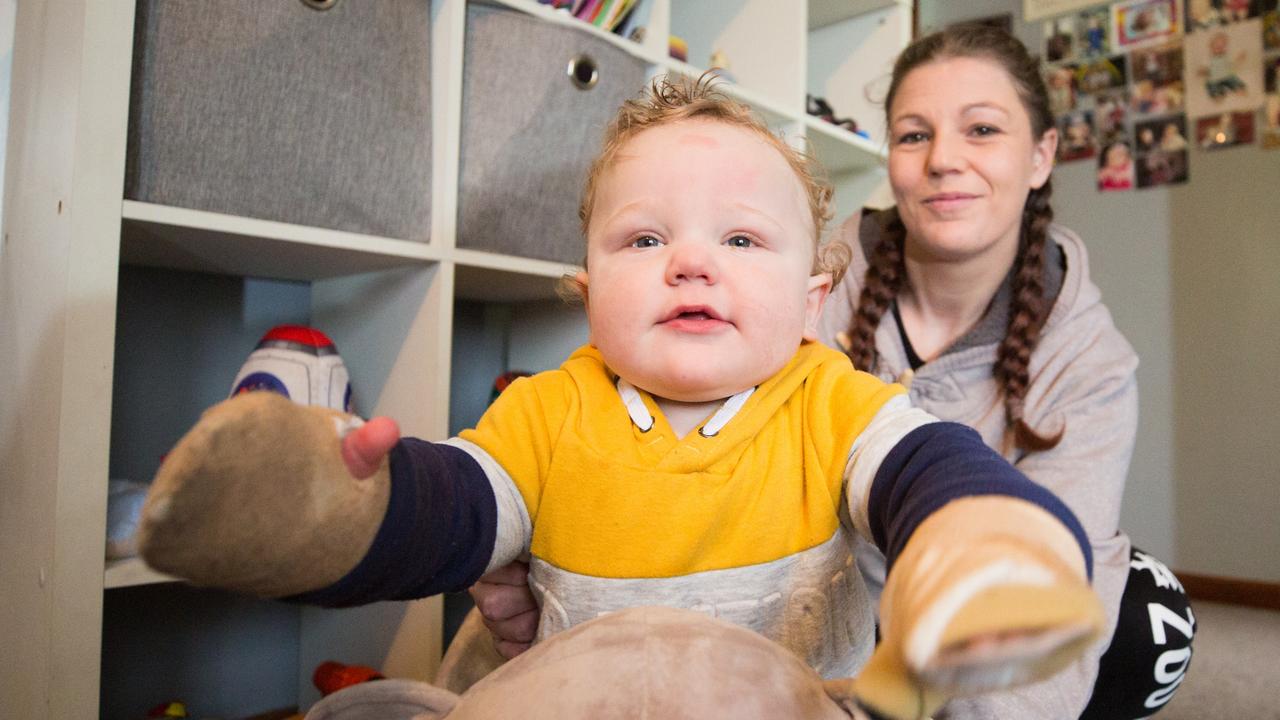 Warning to parents after boy seriously burnt on wood heater | The Mercury