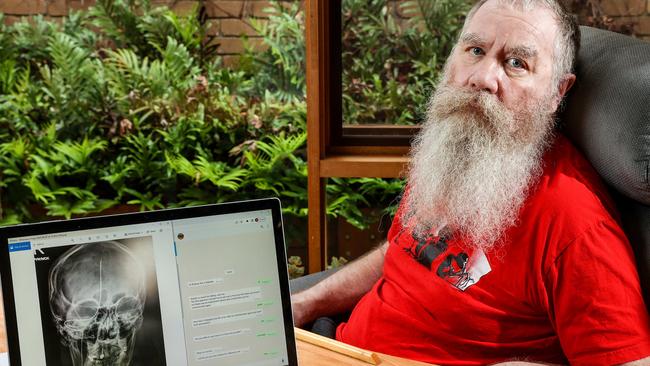 Rodney Gorhman, who is paralysed with motor neurone disease, recently had a stentrode implanted in his brain, which allows him to communicate via text and email. NCA NewsWire / Ian Currie