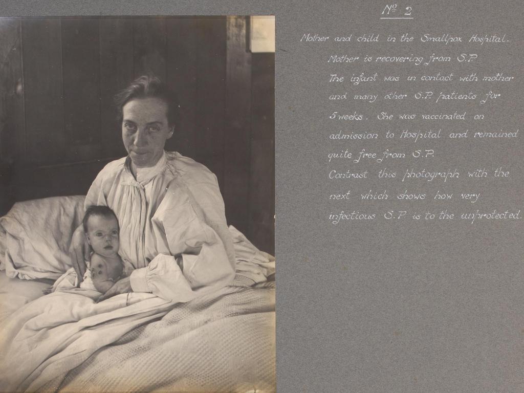 A mother pictured with her child in a smallpox hospital. The caption says the baby was vaccinated on admission to hospital and was “quite free from smallpox”. Picture: The Jenner Trust.