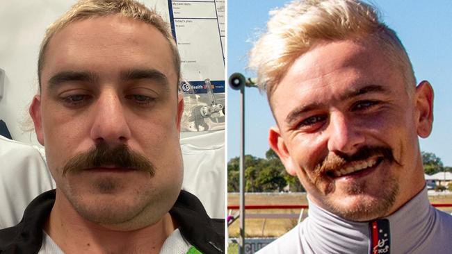 Star Qld jockey Ashley Butler’s jaw was broken in five places in a nightclub assault. The aftermath of the attack (left) and in happier times before the attack (right).