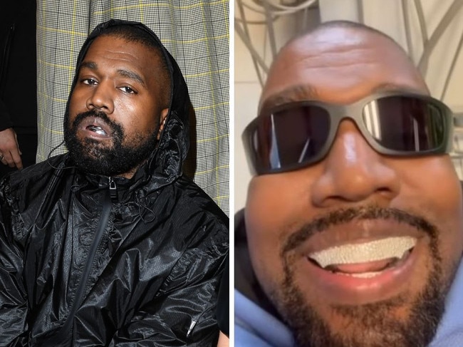 Kanye West and Bianca Censori to sue Beverly Hills dentist for getting rapper hooked on nitrous gas