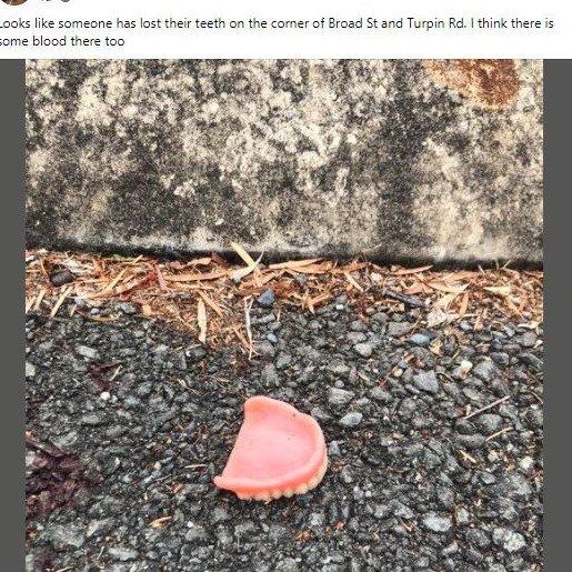 A resident's post about dentures and 'some blood' found on Labrador road. Picture: Facebook