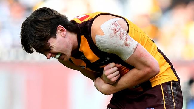 MELBOURNE, AUSTRALIA - AUGUST 18: Will Day of the Hawks receives medical attention during the round 23 AFL match between Hawthorn Hawks and Richmond Tigers at Melbourne Cricket Ground, on August 18, 2024, in Melbourne, Australia. (Photo by Josh Chadwick/AFL Photos/via Getty Images)