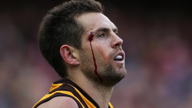 Just a little cut above the eye, all in a day’s work for Hodgey.