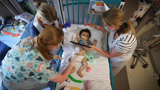 Baby Harlen was hooked up to tubes and needed regular bandage changes. Picture: David Caird