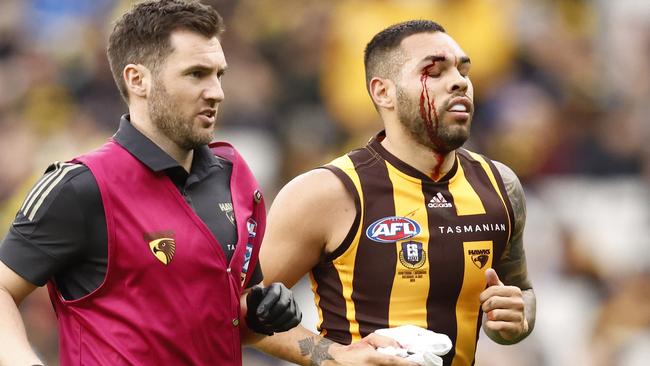 Jarman Impey leaves the field under the blood rule.