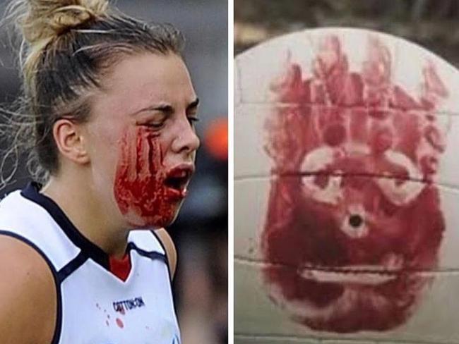 Marinoff made light of the incident on social media, likening herself to “Wilson” the volleyball from Tom Hanks film Castaway. Picture: Instagram