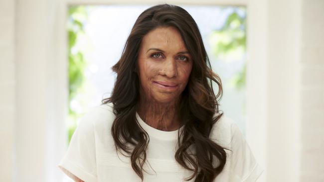 Turia Pitt.