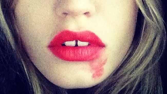 Smeared Lipstick Selfie Campaign For Pap Smears Goes Viral Au — Australias Leading 5827