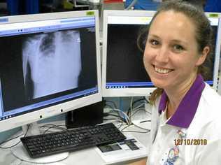 LOOKING BACK: Nurse Melissa Allsopp looks at her chest x-ray from four years ago showing a severe pneumonia infection.