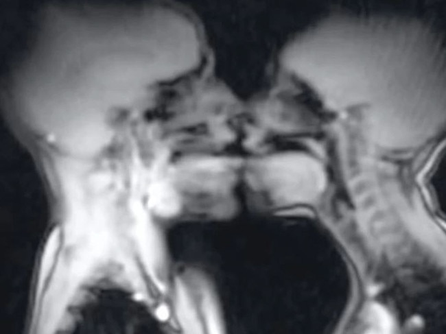 In 1991, a couple had sex in an MRI machine, and the story is going viral on TikTok. Picture: BMJ