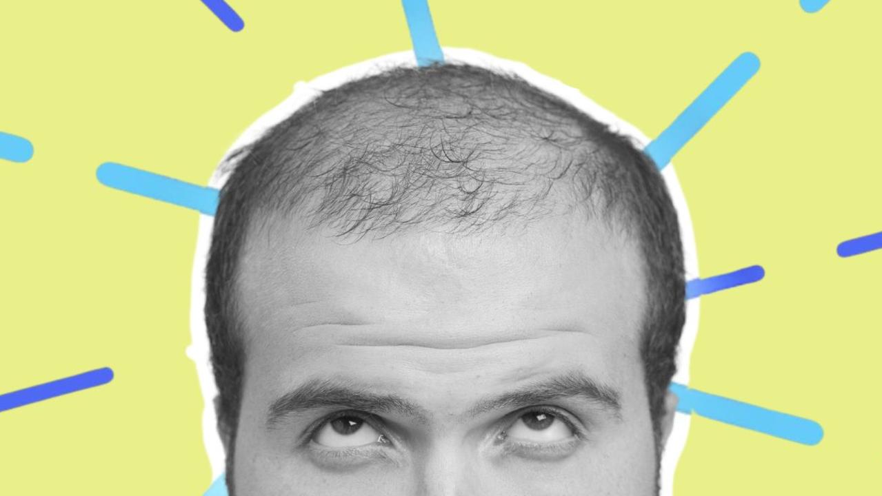 Worried about what’s going on up top? Here’s how to best manage going bald