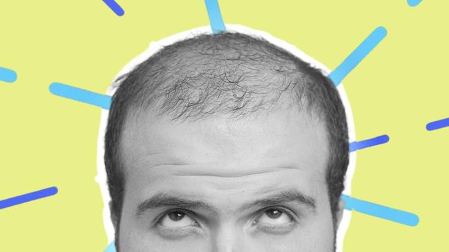 Balding is optional, the experts say, if you are prepared to seek treatment early enough.