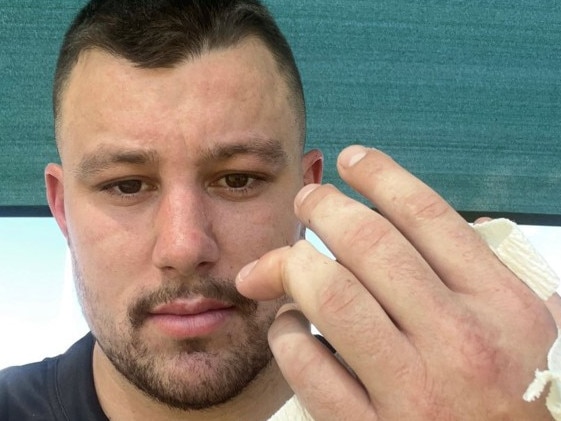 Rugby league player Riley Reid badly dislocated his finger playing for the Rocky Rustlers at the 47th Battalion Trophy.