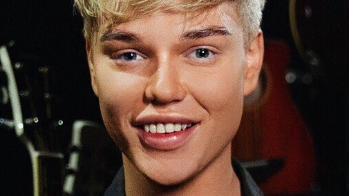 Jack Vidgen opens up about his cosmetic procedures.