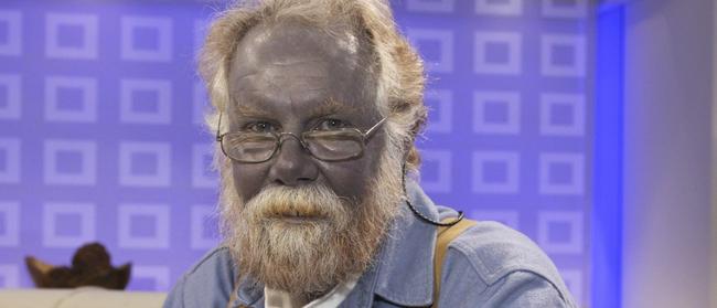 US man Paul Karason turned blue after years of taking colloidal silver regularly.