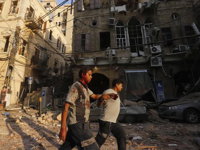 A wounded man is helped as he walks through debris in Beirut's Gemmayzeh district. Picture: AFP