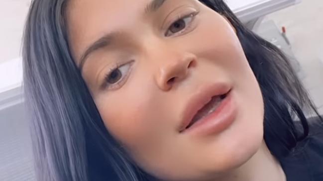 Kylie Jenner talks post-partum struggles. Picture: Instagram