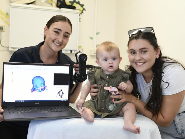 Prosthetist orthotist Chloe Botella, Frankie Powell and Rhianna Powell at Townsville University Hospital with a new state-of-the-art scanning tool which uses blue light to capture the shape of a childâs head. The information is used to create custom helmets to help correct uneven or flattened head shapes.