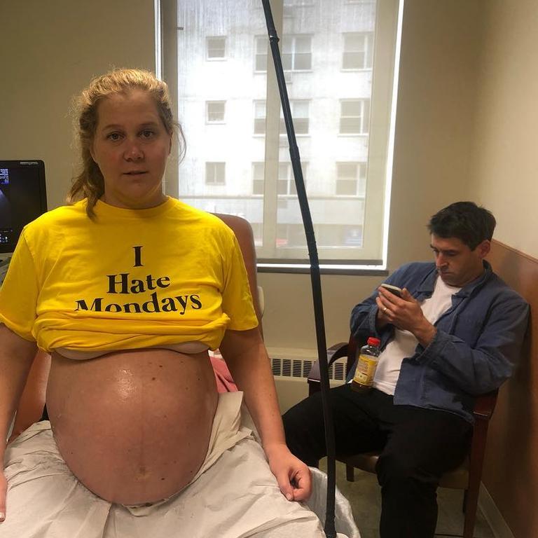 Amy Schumer has shared her pregnancy with fans throughout.