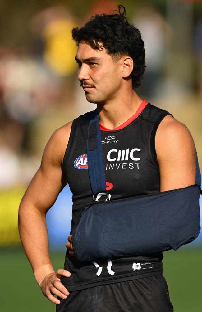 Mitch Owens won’t require surgery. Picture: Quinn Rooney/Getty Images.