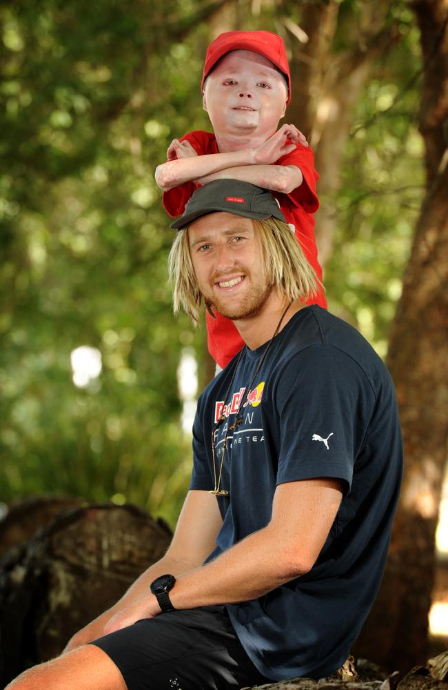 Harrison Pennicott, who suffers from an extremely rare condition called Scleroderma Pansclerotic Morphea, with Essendon's Dyson Heppell. Picture: Andrew Henshaw