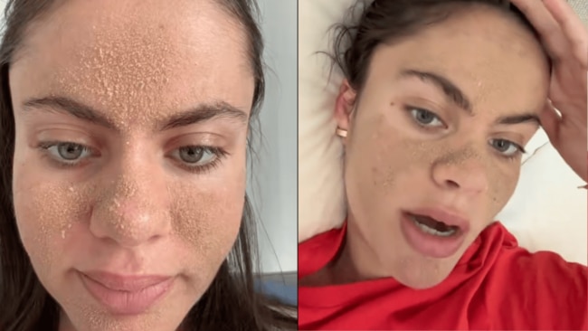 Thanks to TikTok’s unmatched ability to make just about anything go viral in a matter of days, we've seen our fair share of bizarre skincare and beauty trends pop up in the last 12 months. But unlike the homemade flax-seed masks and trendy sold-out products we’re usually told will change our lives for the better, one creator has shot to fame on the platform in recent weeks for her controversial approach to skincare.In a bid to simplify her routine and rebuild her skin’s damaged barrier naturally, 22-year-old influencer Tia Zakher has been documenting her skin health journey using a Stone Age-inspired routine: Caveman skincare. 