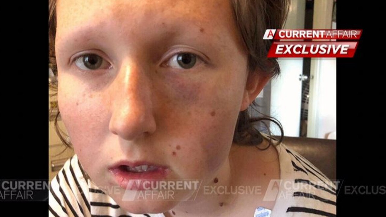 Ms Kendrigan told ACA the ordeal would ‘always’ be with her.